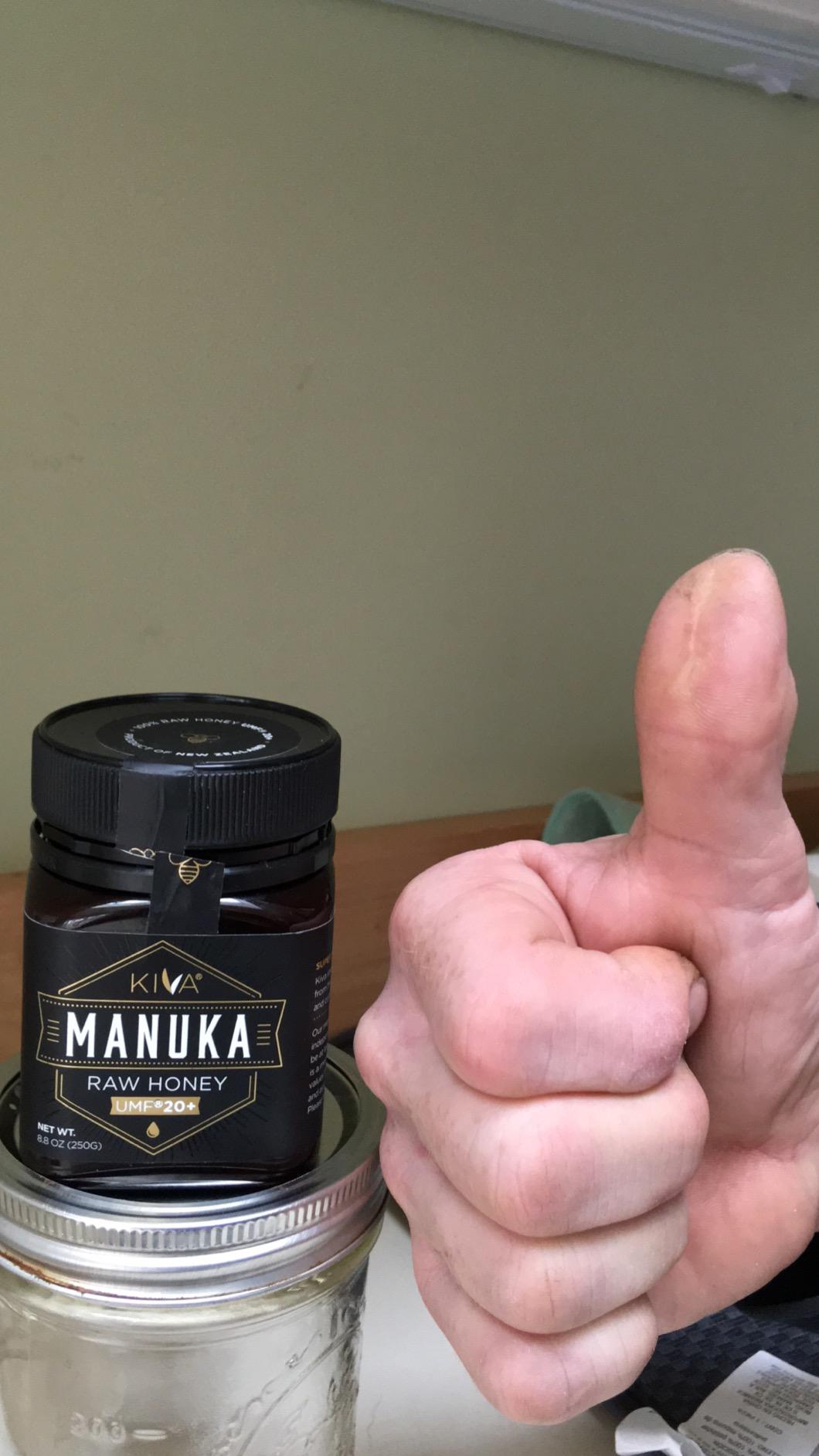 Kiva Raw Manuka Honey Certified UMF 20+, MGO 850+ 100% Pure New Zealand Honey - Non-GMO, Traceable, Non-Glyphosate (8.8 oz) customer photo 1
