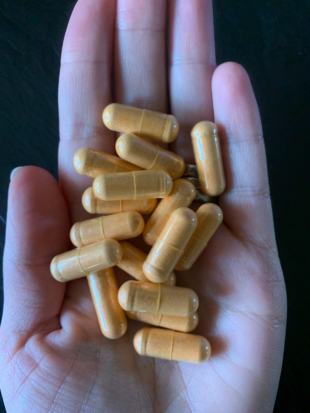 THORNE - Curcumin Phytosome 1000 mg (Meriva) - Clinically Studied, High Absorption - Supports Healthy Inflammatory Response in Joints, Muscles, GI Tract, Liver, Brain & Nerves* - 60 Servings customer photo 1