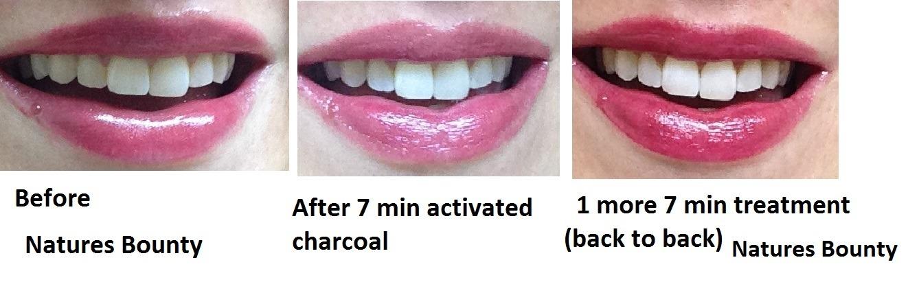 Nature's Bounty Activated Charcoal 260 mg, 100 Capsules, Dietary Supplement to Support a Healthy Lifestyle customer photo 2