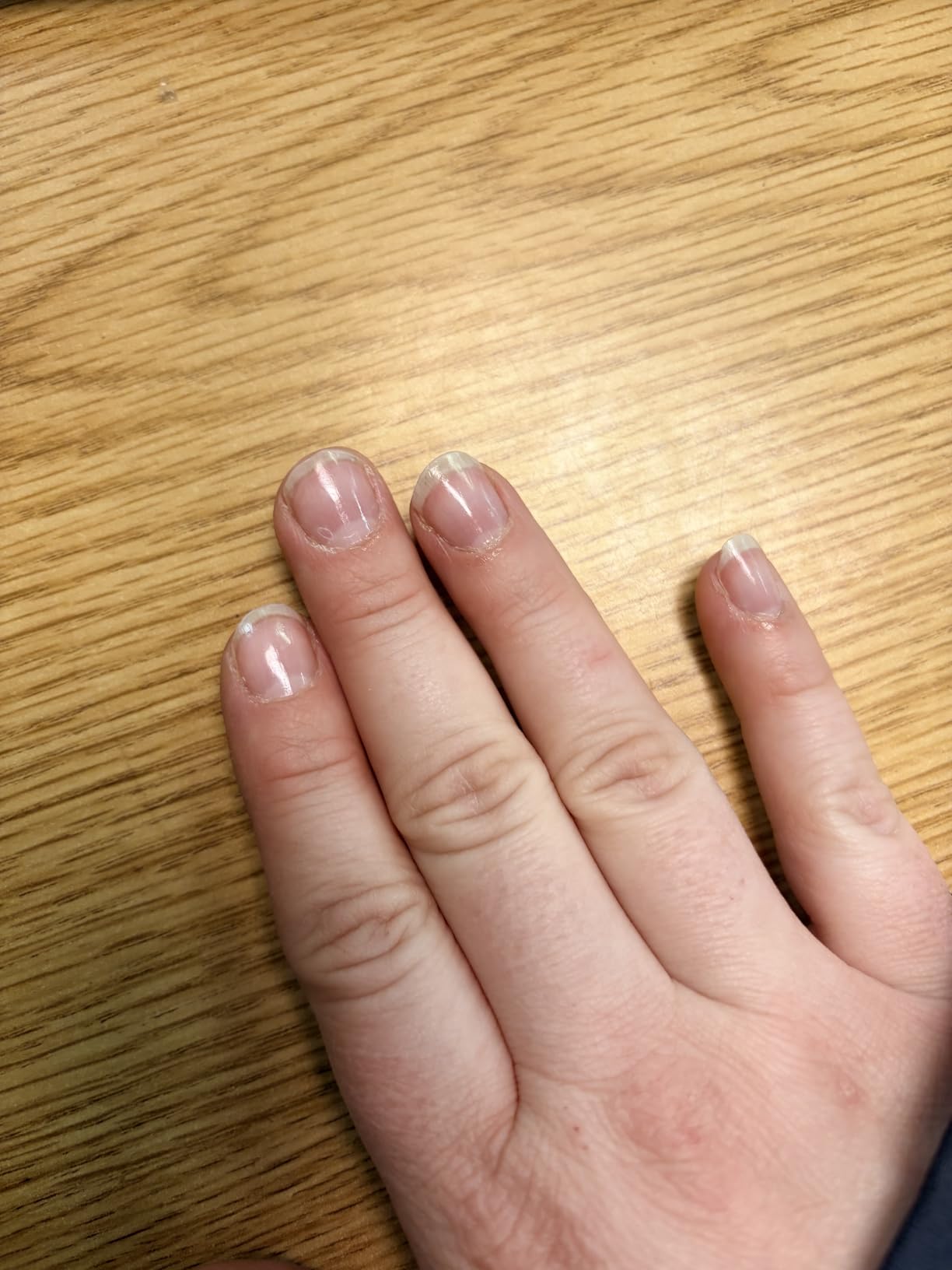 Horbaach Hair Skin and Nails Vitamins | 300 Softgels | with Biotin and Collagen | Infused with Argan Oil and Coconut Oil | Non-GMO, Gluten Free Supplement customer photo 2