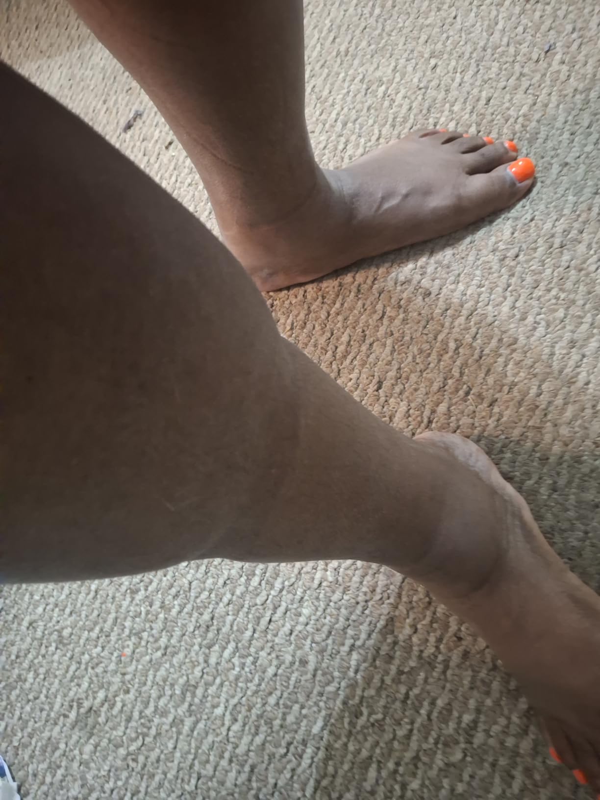 Nature's Way Horse Chestnut Extract, Premium Extract, Supports Healthy Leg Veins, Standardized to 20% Aescin, Non-GMO Project Verified, Gluten Free, Vegan, 90 Capsules customer photo 2