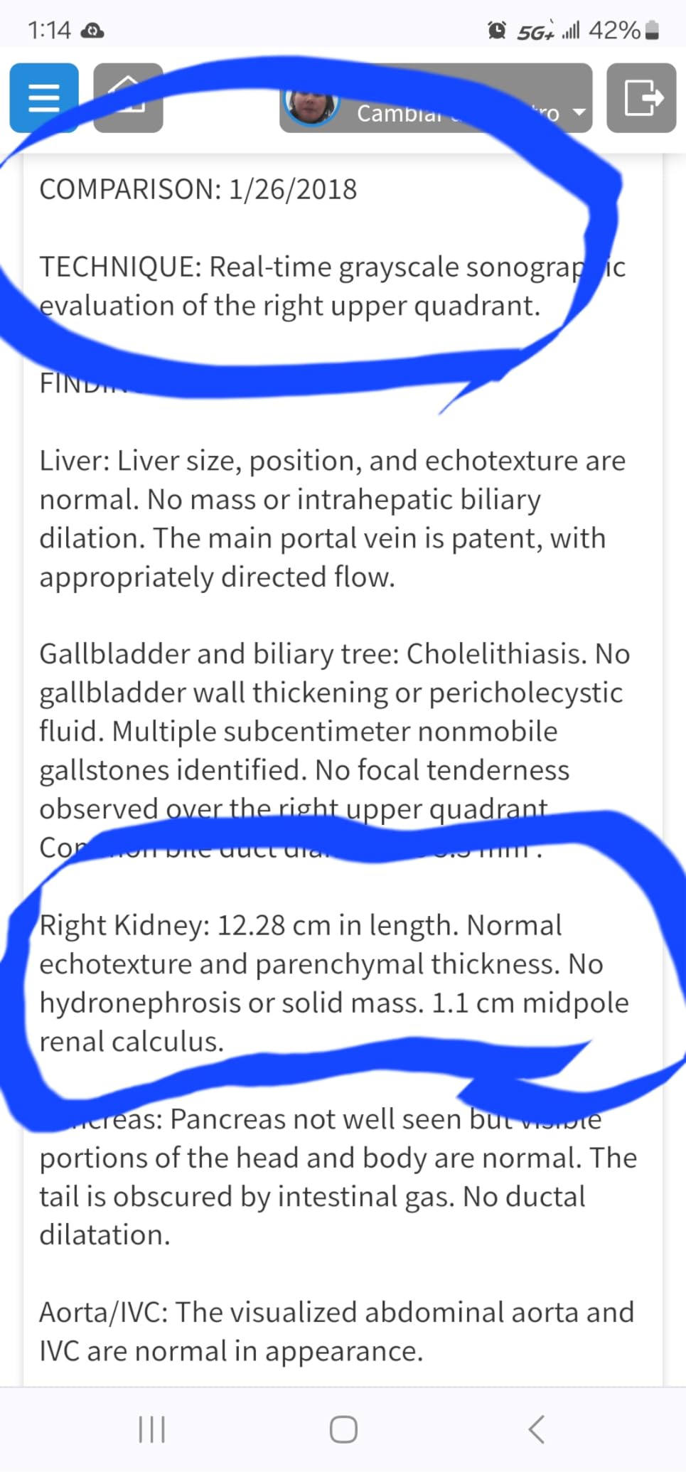 Christopher's Original Formulas Liver & Gallbladder Formula Capsules - Gallbladder Supplements with Digestive Enzymes & Natural Herbs customer photo 2