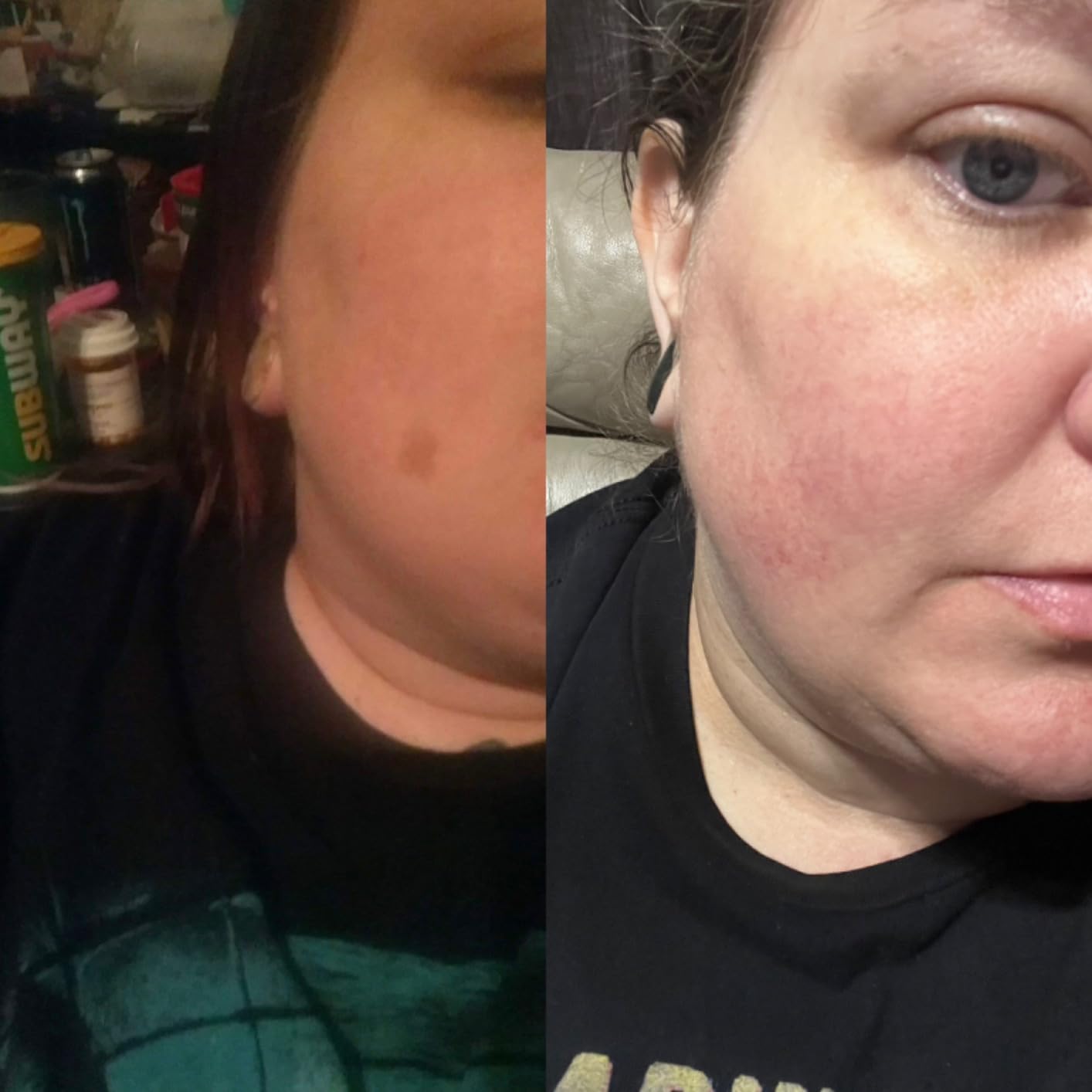 100 Pure Montana Emu Oil (4 Fluid Ounces) customer photo 1