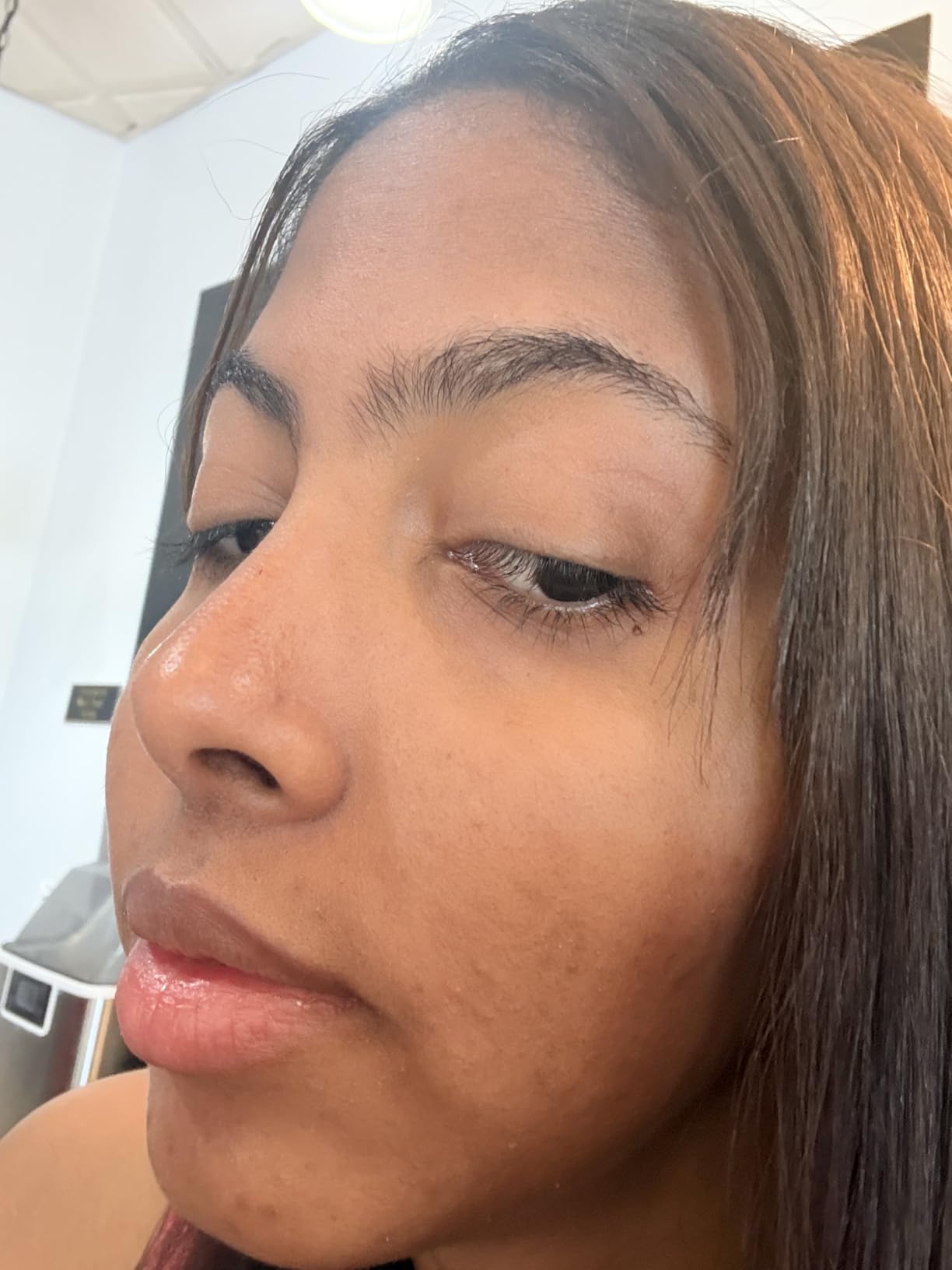 EltaMD UV Clear Face Sunscreen SPF, Oil-Free Sunscreen with Zinc Oxide, Dermatologist Recommended customer photo 1