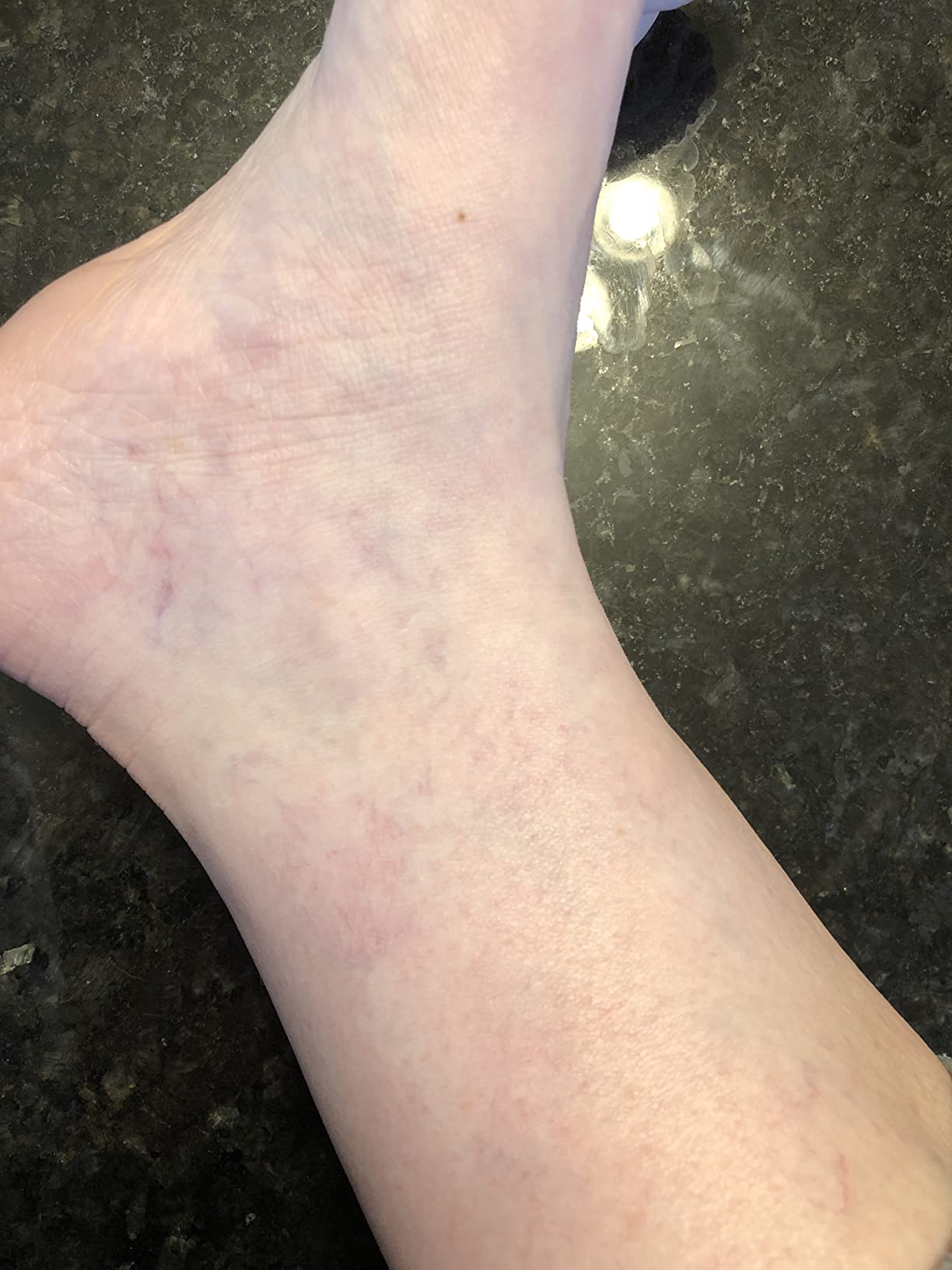 Global Healing Plant-Based Vein Health Liquid Vegan Supplement Drops to Support Blood Flow & Circulation, Helps with Spider & Varicose Veins for Healthy Legs - Organic Horse Chestnut Root - 2 Fl oz customer photo 2