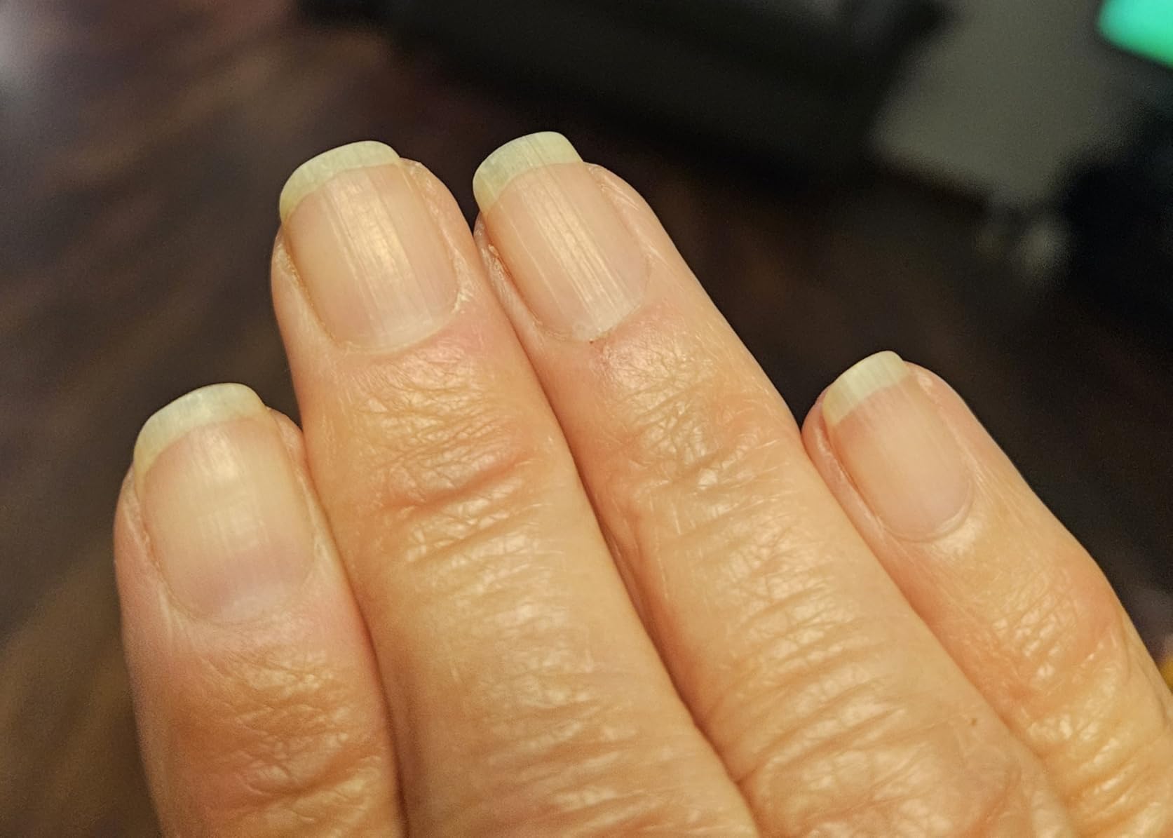 Youtheory Advanced Collagen - 6,000 mg Hydrolyzed Collagen Peptides - Includes Antioxidants & Contains Vitamin C - Hair Growth, Nails, Joint Health & Bone Support* - 290 Tablets (48-Day Supply) customer photo 1