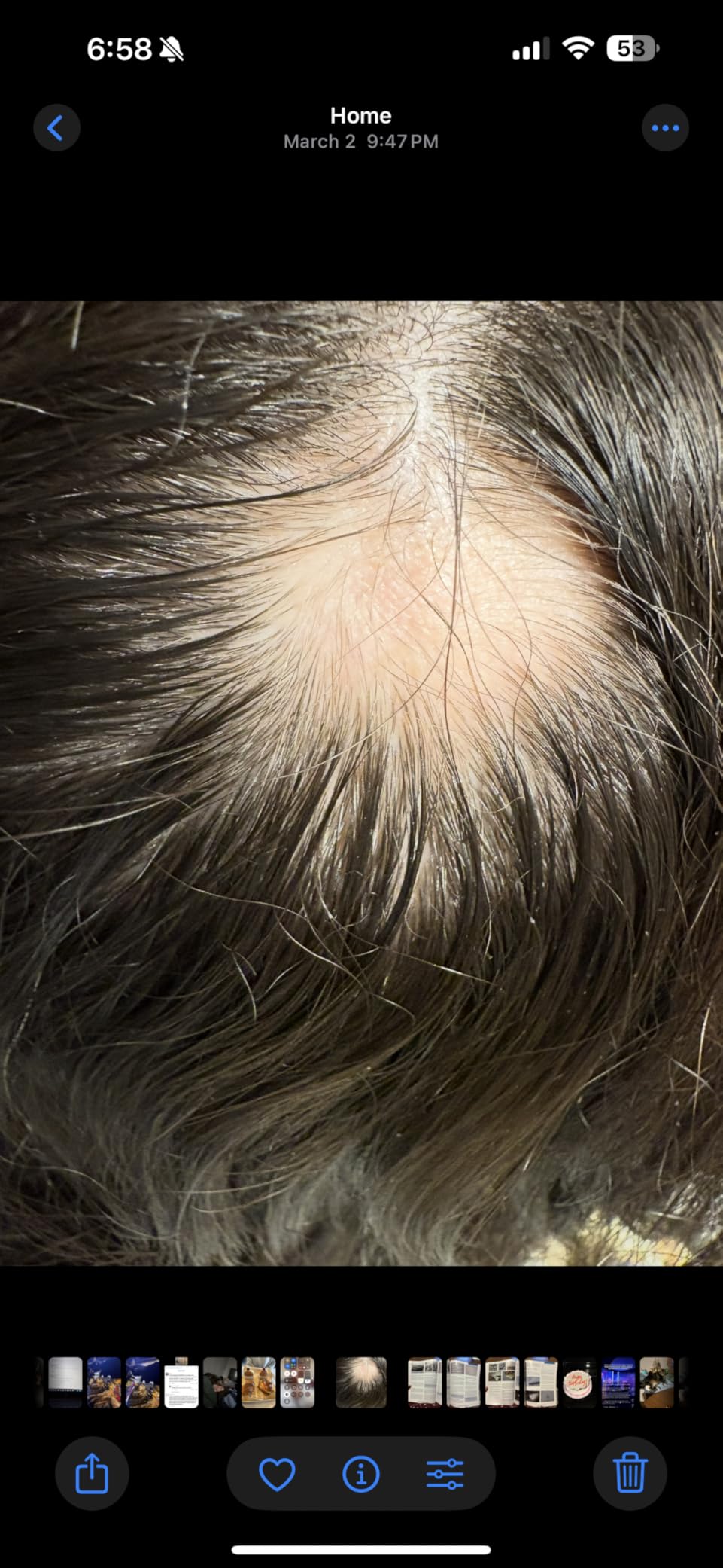 Nutrafol Women's Hair Growth Supplements, Ages 18-44, Clinically Tested for Visibly Thicker and Stronger Hair, Dermatologist Recommended - 1 Month Supply customer photo 1