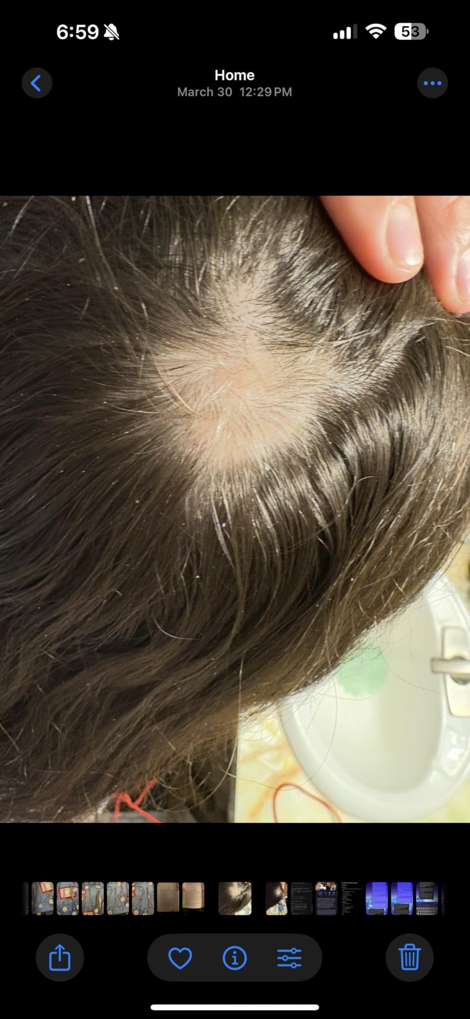 Nutrafol Women's Hair Growth Supplements, Ages 18-44, Clinically Tested for Visibly Thicker and Stronger Hair, Dermatologist Recommended - 1 Month Supply customer photo 2