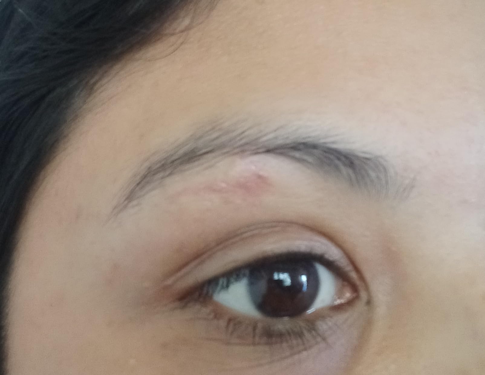 The Ordinary 100% Organic Cold-Pressed Rose Hip Seed Oil, Addresses Signs of Aging by Improving the Appearance of Uneven Skin Tone, Supporting Skin Elasticity, 1 Fl Oz customer photo 2