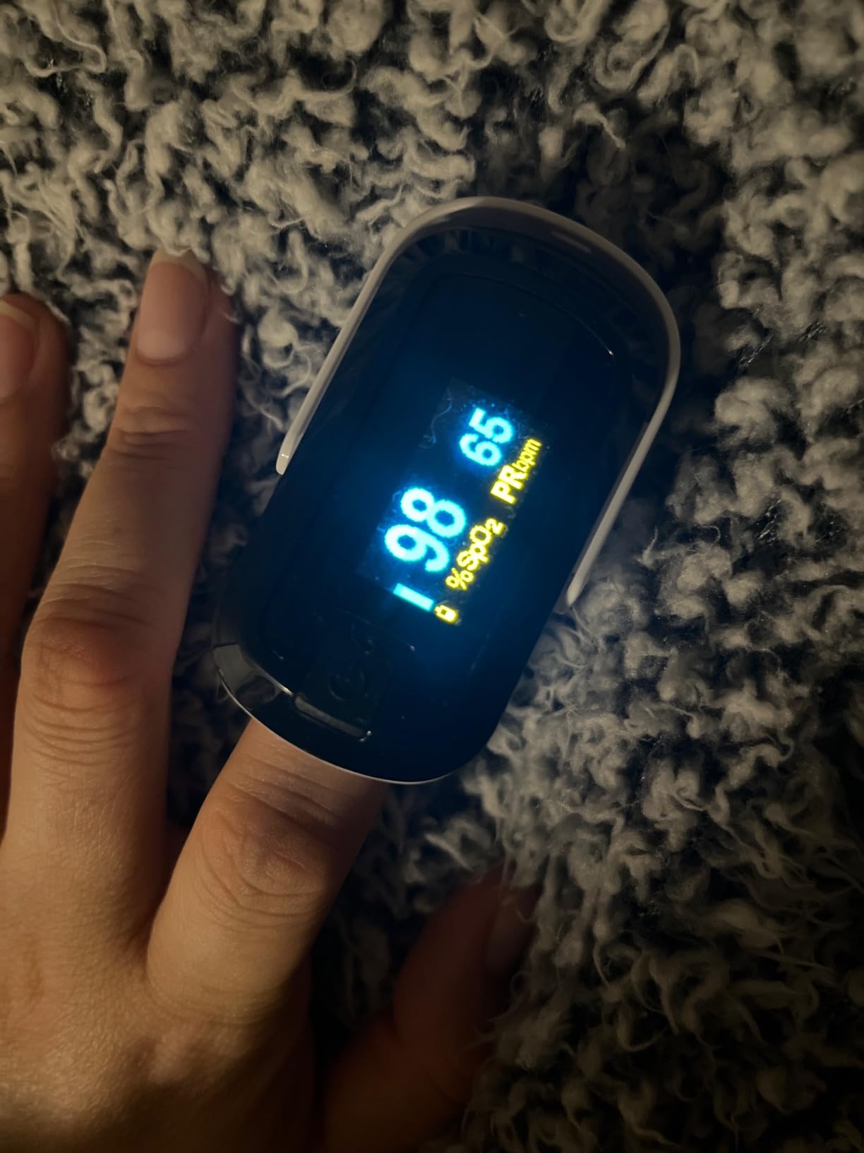 mibest OLED Finger Pulse Oximeter, O2 Meter, Dual Color White/Black customer photo 2