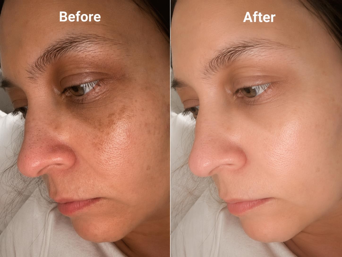 La Roche-Posay Pure 12% Vitamin C Serum For Face With Hyaluronic Acid & Salicylic Acid, Hydrating Face Serum, Boost Radiance & Reduce Wrinkles, 2 Formulas for Normal or Oily Skin Control customer photo 1