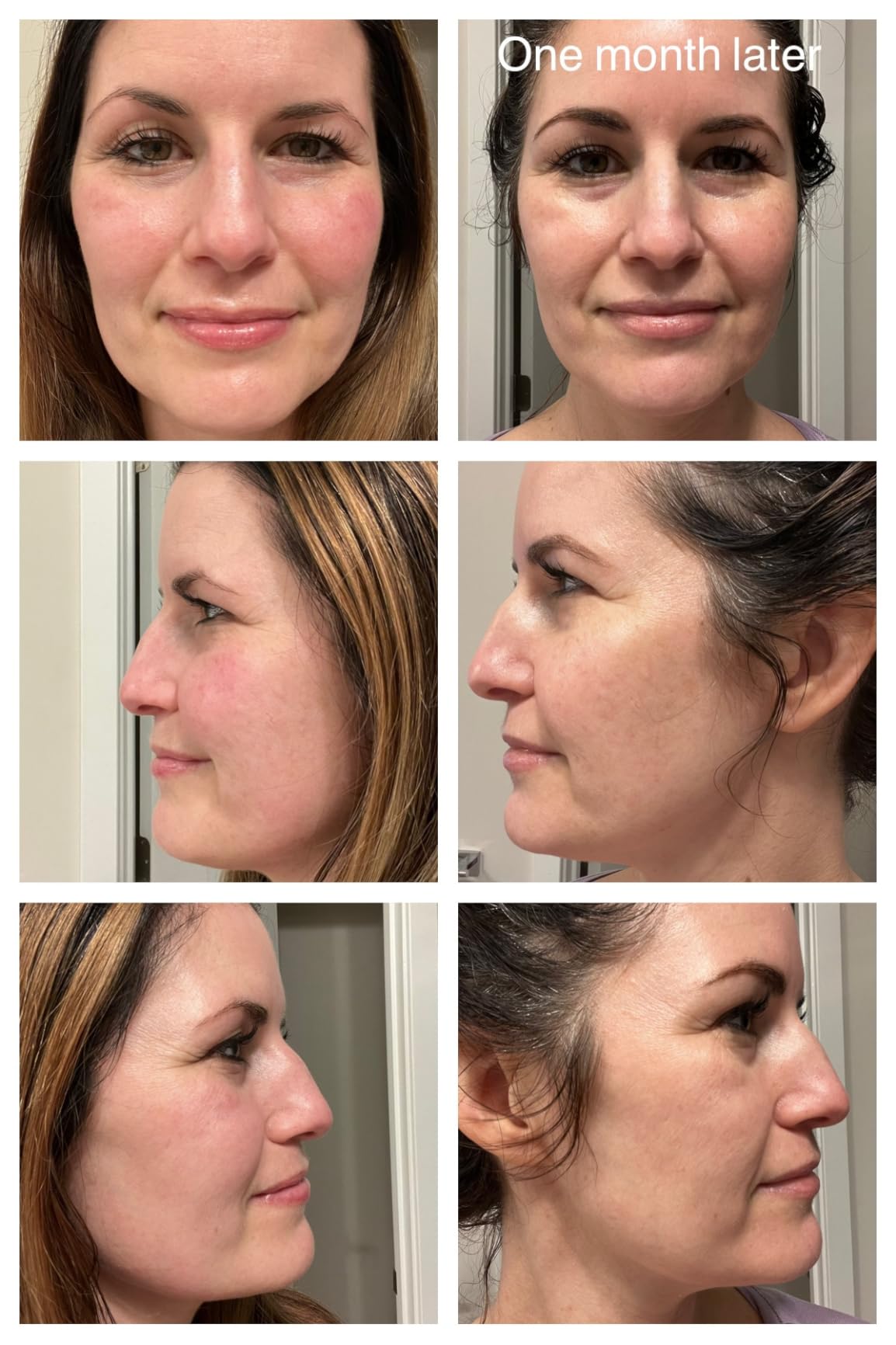 CeraVe Vitamin C Serum for Face with 10% Pure Vitamin C, Hyaluronic Acid & 3 Essential Ceramides, Skin Brightening Antioxidant Serum, Hydrates & Improves Skin Tone & Texture, Fragrance-Free, 1oz customer photo 2