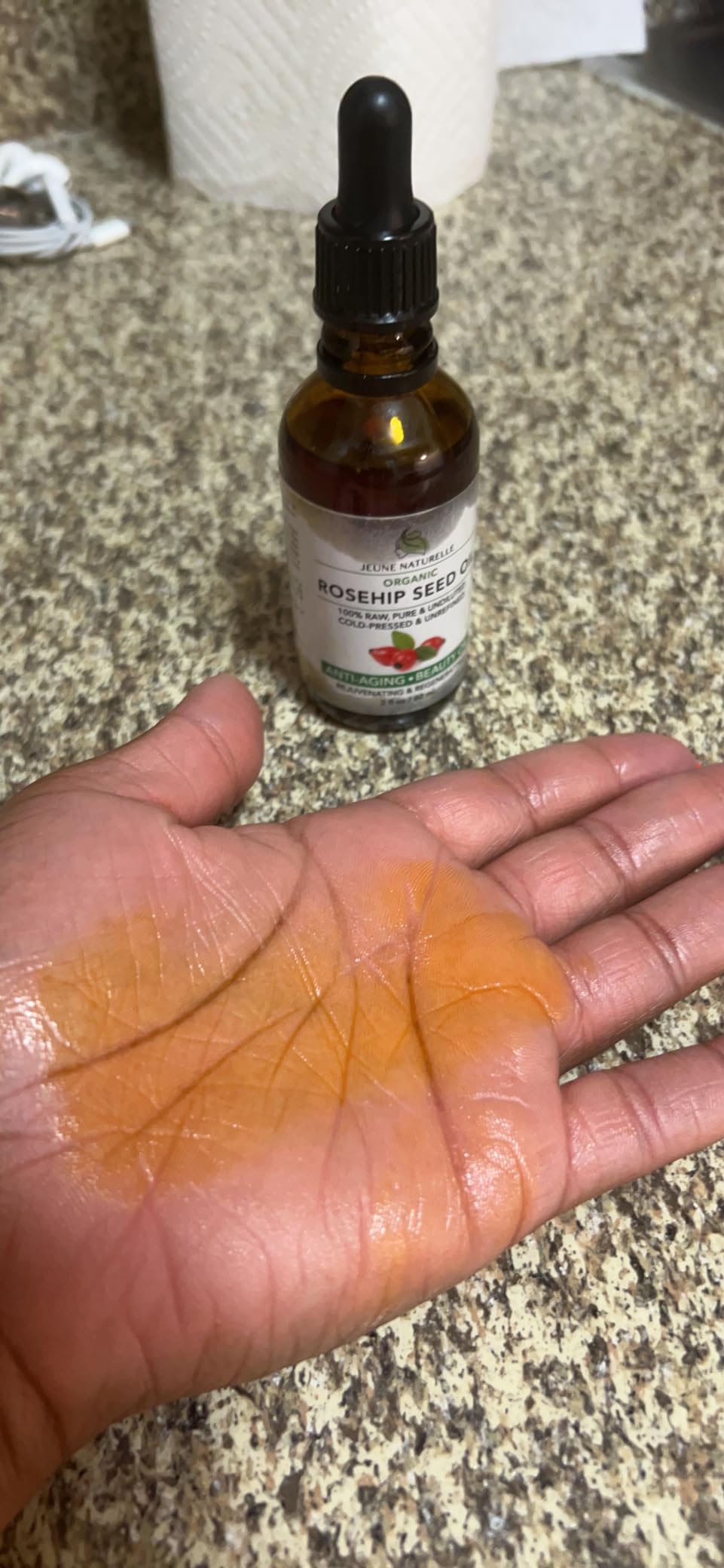 Jeune Naturelle Rosehip Oil - Pure, Virgin, Cold Pressed - From Whole Berries (Pulp & Seeds), Natural Deep Orange Hue for Intensive Skin Repair - Undiluted Organic Rosehip Seed Oil, 2 oz customer photo 1