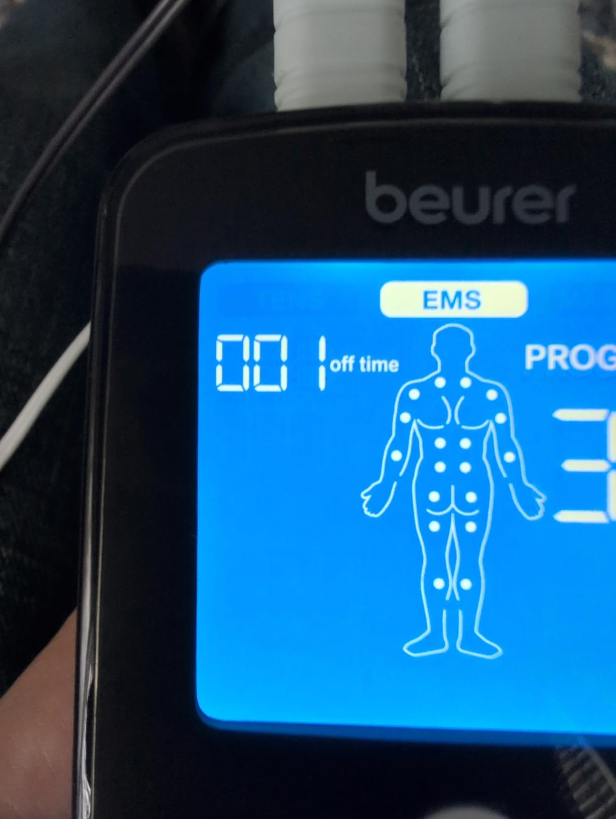 Beurer EM59 Digital 3-in-1 TENS Unit, EMS & Heat Therapy for Pain Relief & Relaxation, Muscle Stimulator with 2 Adjustable Channels, 64 Applications, Timer Function customer photo 1