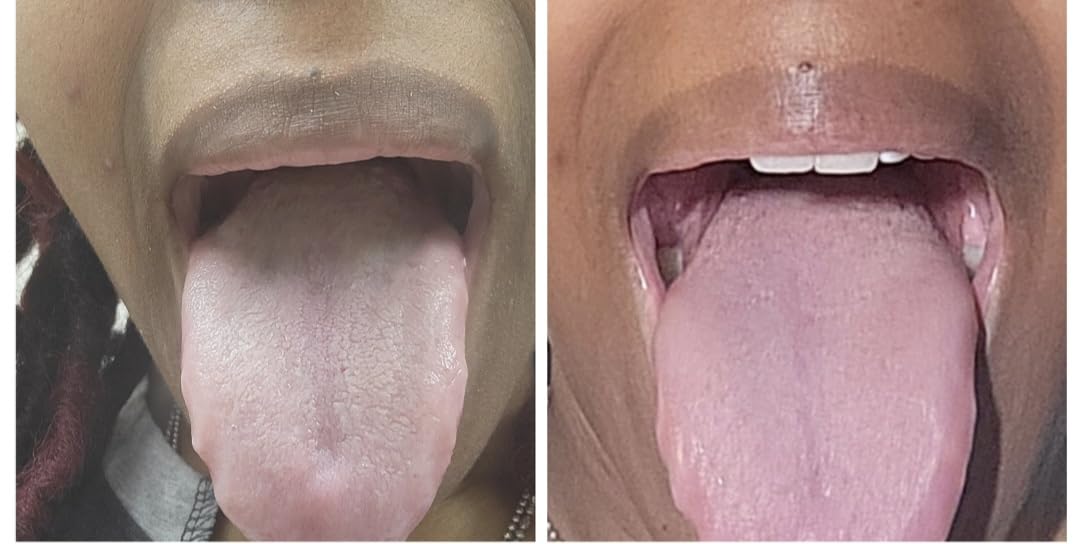 Cafhelp 2-Pack Tongue Scraper, 100% 304 Surgical Stainless Steel Tongue Cleaner for Both Adults and Kids, Professional Reduce Bad Breath Metal Tongue Scrapers, Help Your Oral Hygiene (with 2 cases) customer photo 1