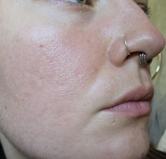Good Molecules Niacinamide Serum - 10% Niacinamide to Target Blemishes, Nourishment, and Skin Tone - Ultra Hydrating Serum and Brightening Skin Care for Face customer photo 2
