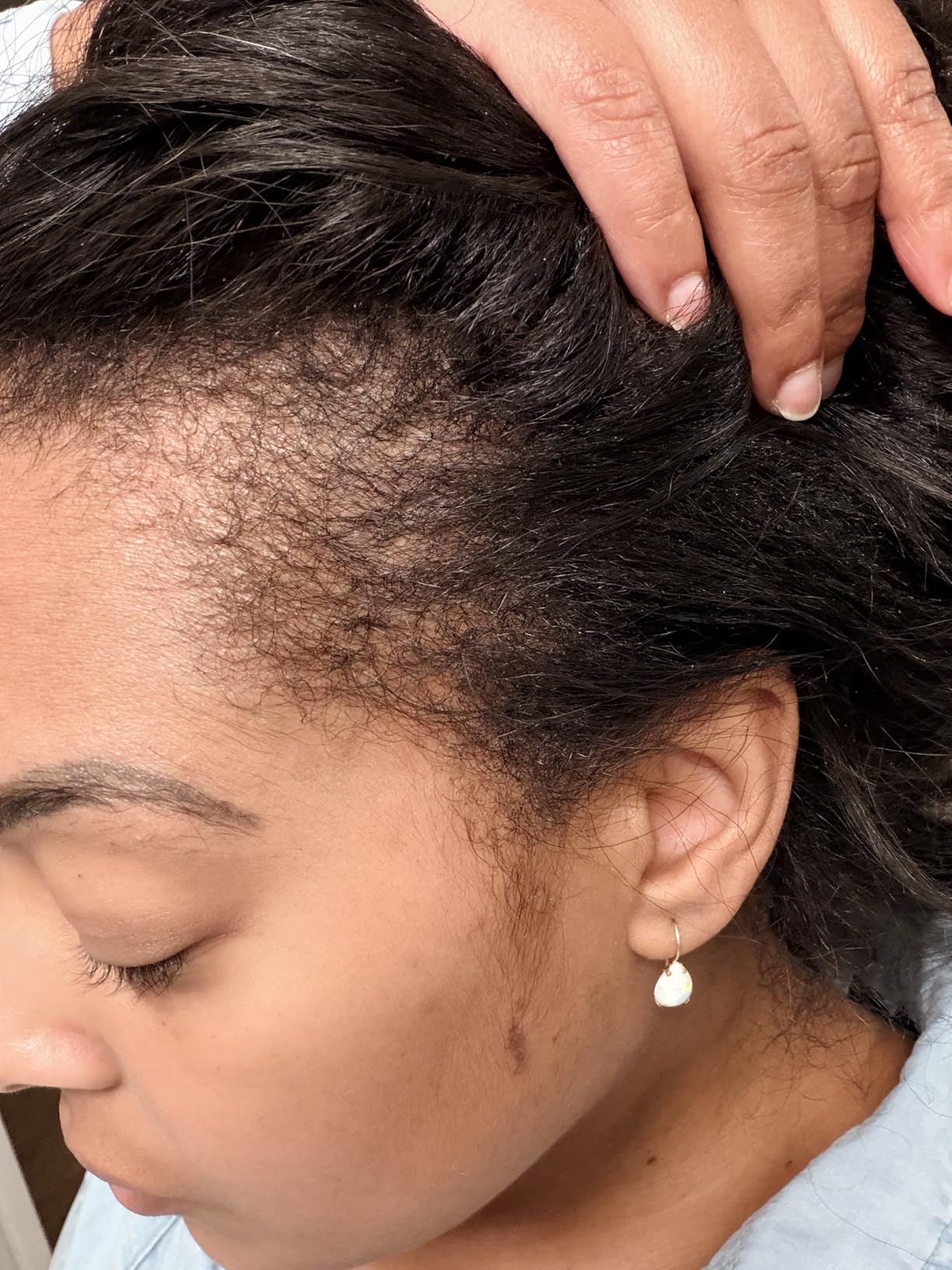 Nutrafol Postpartum Hair Growth Supplements, Clinically Tested for Visibly Thicker Hair and Less Shedding, Breastfeeding-friendly customer photo 2