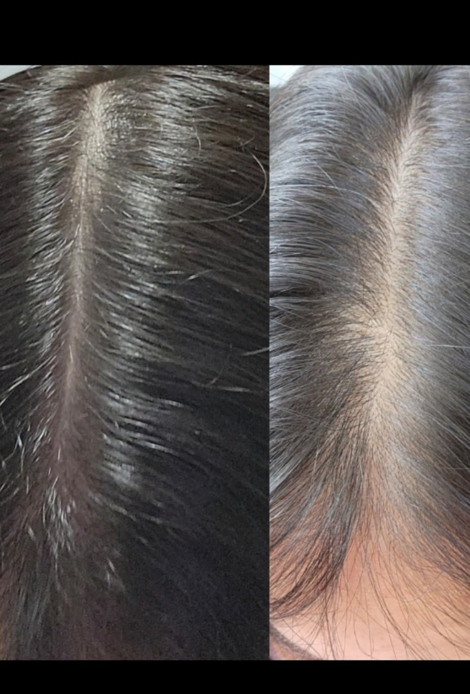 Dr. Berg All-in-One Vitamins for Hair, Skin, & Nails - Advanced Formula with Biotin, Saw Palmetto, DHT Blocker, & Trace Minerals - 90 Veg Capsules customer photo 1
