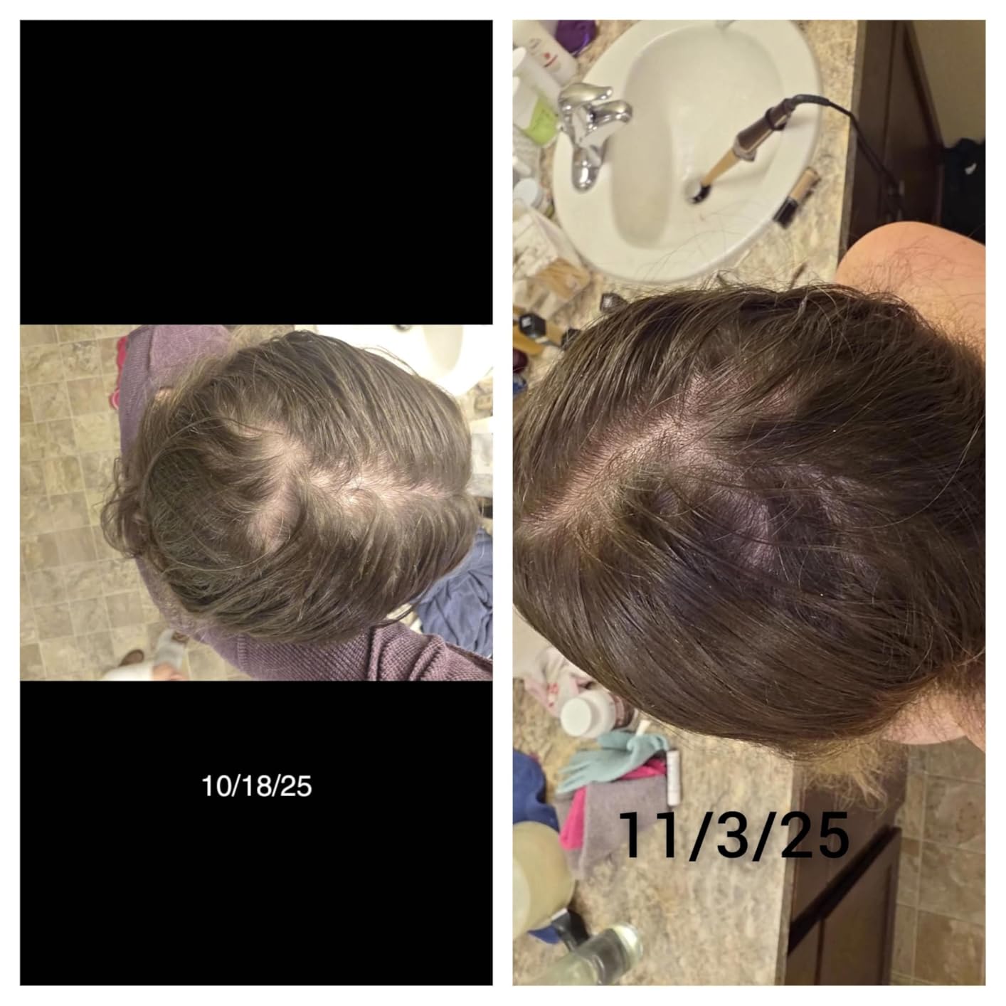 Dr. Berg All-in-One Vitamins for Hair, Skin, & Nails - Advanced Formula with Biotin, Saw Palmetto, DHT Blocker, & Trace Minerals - 90 Veg Capsules customer photo 2