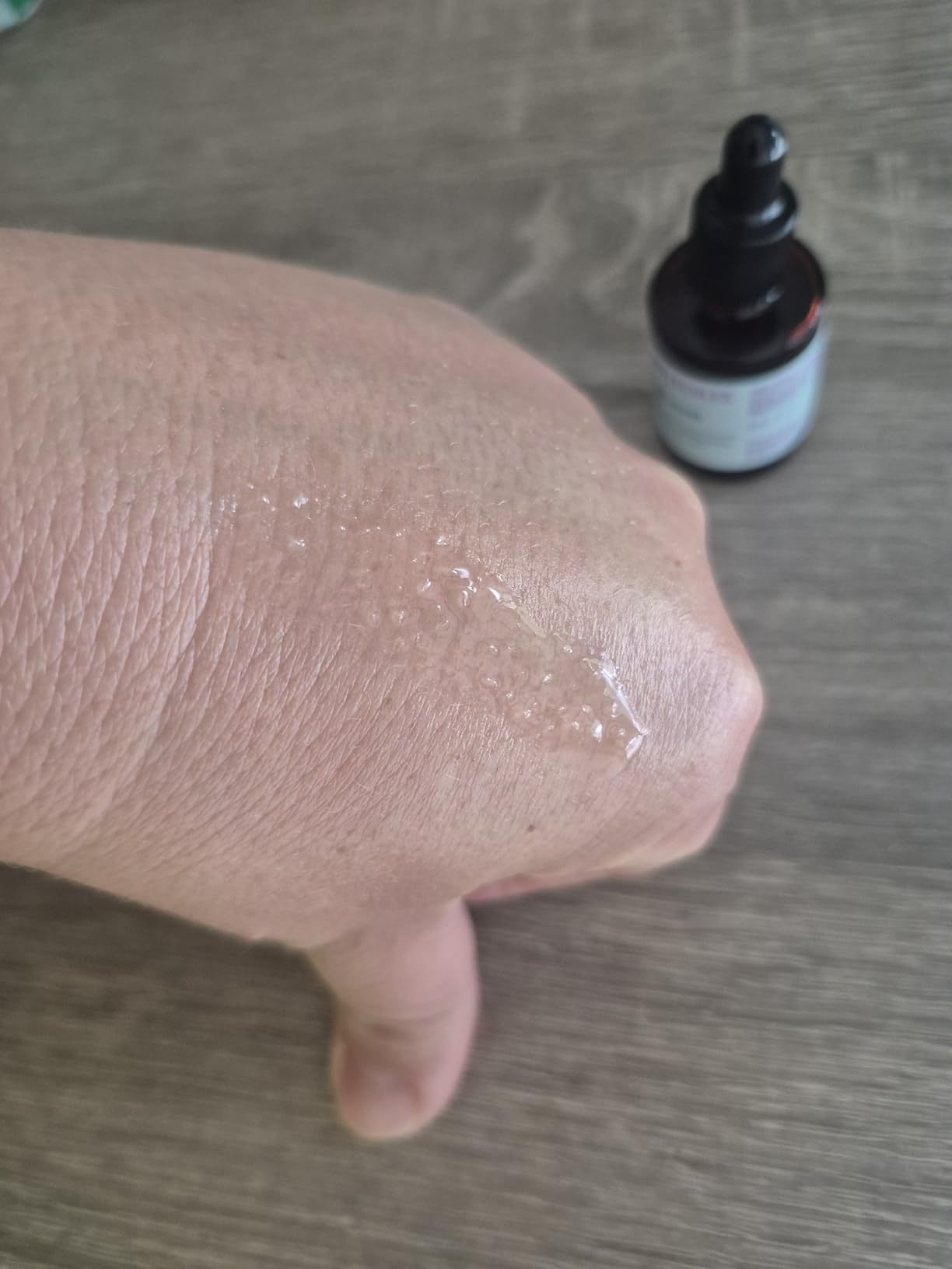 Bakuchiol Oil For Dry Skin - Ultra Hydrating Natural Blend with Bakuchiol and Rosehip Oil, Promotes Collagen Production, Moisturizing Face Oil customer photo 1
