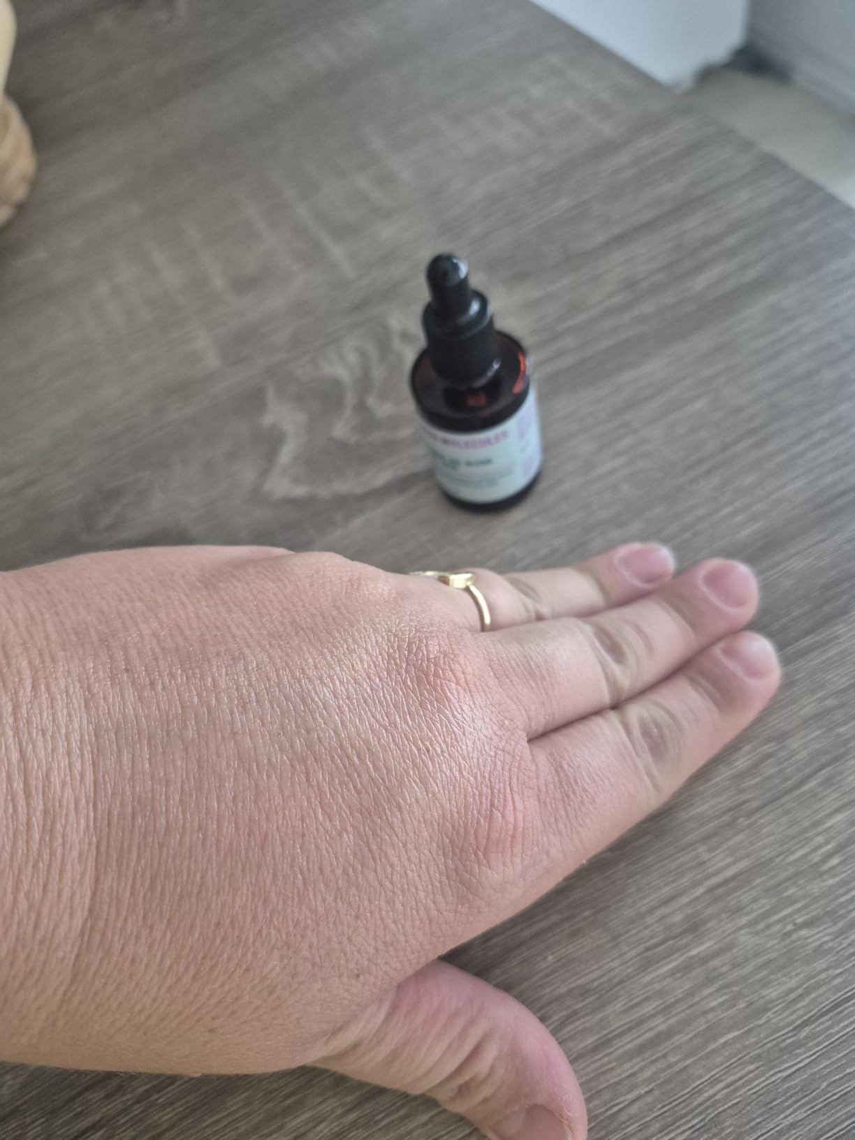 Bakuchiol Oil For Dry Skin - Ultra Hydrating Natural Blend with Bakuchiol and Rosehip Oil, Promotes Collagen Production, Moisturizing Face Oil customer photo 2