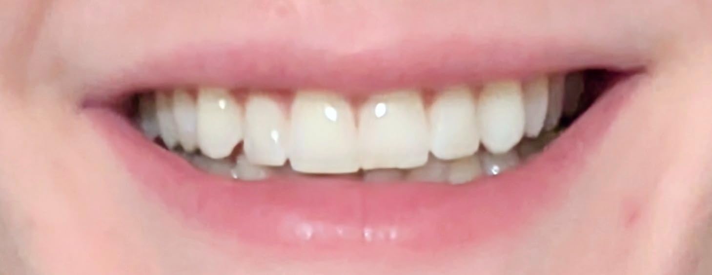 Xylitol Mints 300 Tablets (Peppermint) customer photo 1