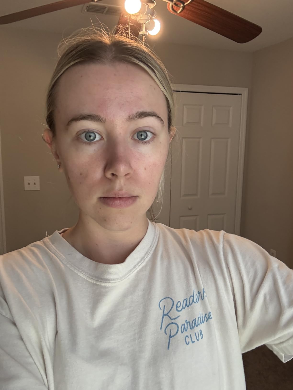 Anua Niacinamide 10 + TXA 4 Serum, Dark Spot Care, Hyaluronic Acid, Tranexamic Acid, Lightweight & Hydrating All-in-One Daily Facial Serum for Glass Skin, Korean Skincare, 1.01 fl.oz customer photo 1