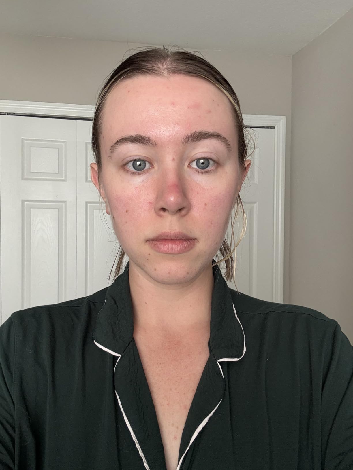 Anua Niacinamide 10 + TXA 4 Serum, Dark Spot Care, Hyaluronic Acid, Tranexamic Acid, Lightweight & Hydrating All-in-One Daily Facial Serum for Glass Skin, Korean Skincare, 1.01 fl.oz customer photo 2