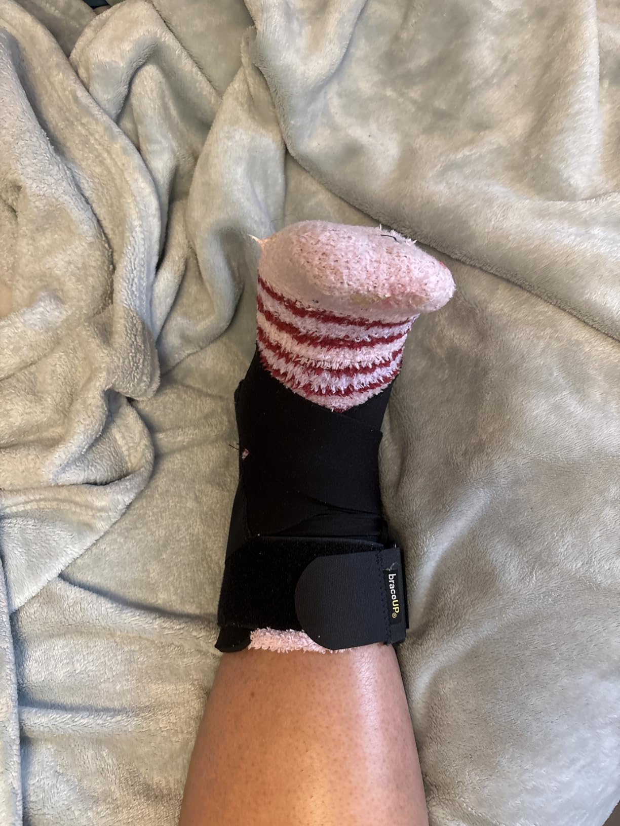 BraceUP Ankle Brace - Relieve Pain, Enhance Stability for Foot Pain, Sprained Ankle, Achilles Tendonitis, Men and Women (Black) customer photo 1