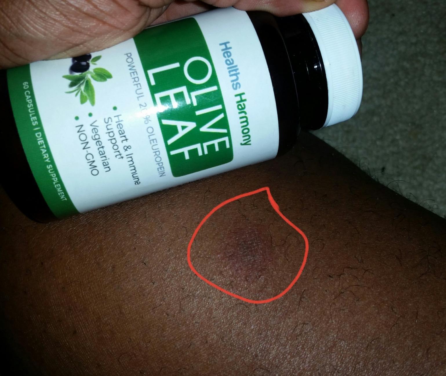 Super Strength Olive Leaf Extract Capsules - Vegan Non-GMO 750mg Olive Extract with 20% Oleuropein Antioxidant Supplement for Immunity Skin and Heart Health Support - Made in The USA (6 Month Supply) customer photo 2