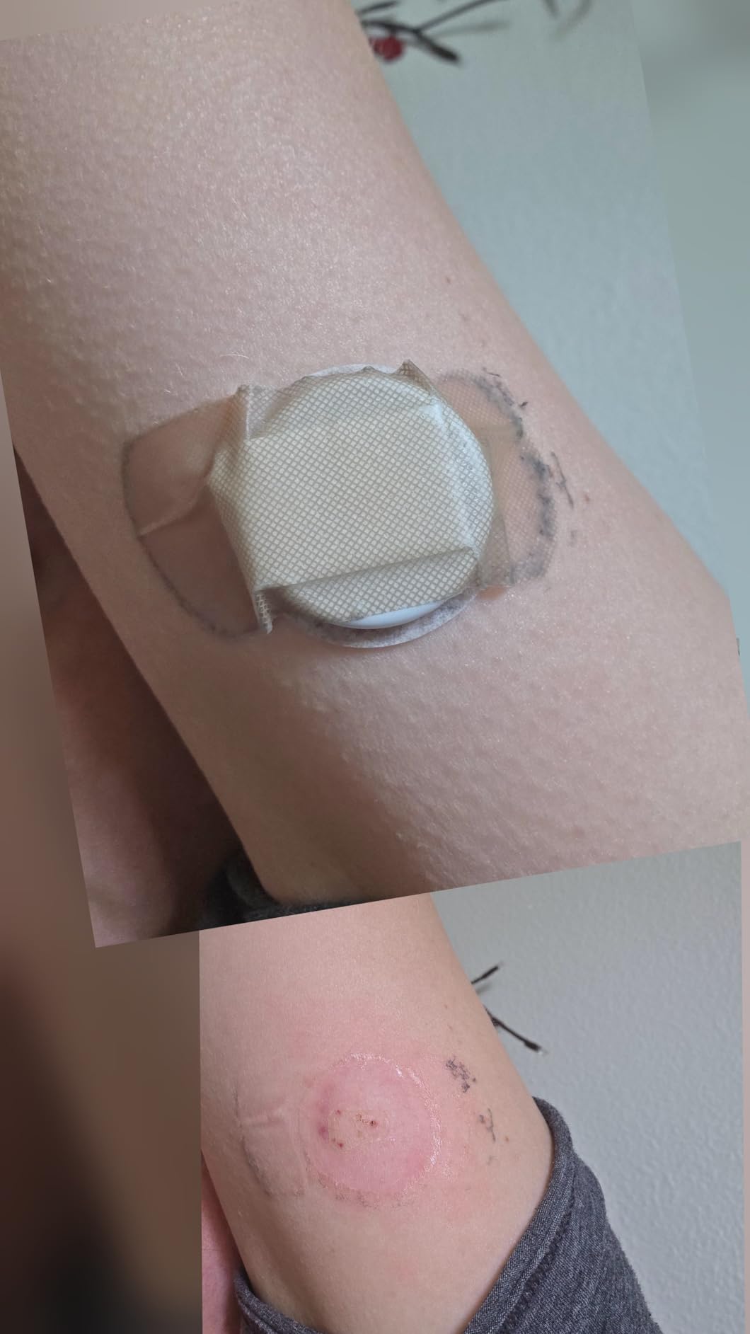 Lingo Continuous Glucose Monitor (CGM) by Abbott - Real-time Glucose Data & Insights, 14-Day Biosensor customer photo 2