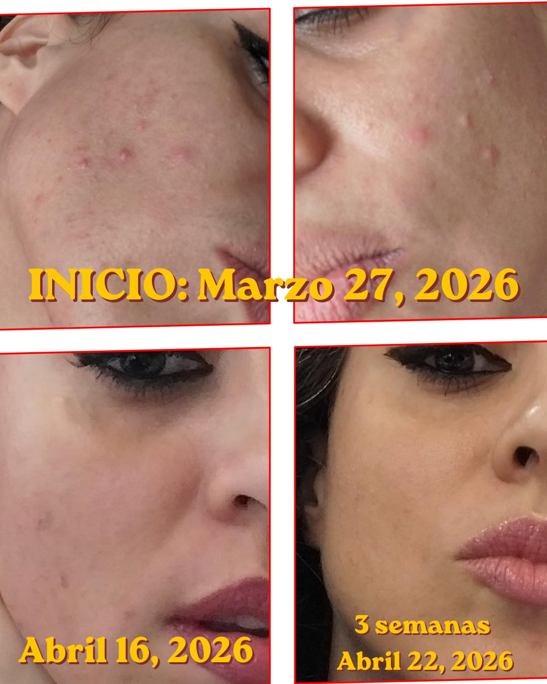 medicube TXA+Niacinamide 15% Glow Facial Serum for After Spot Care | All-in-One Daily Korean Skincare | Uneven Skin Tone, Texture, and Hydration Care | High-Potency Tranexamic Acid 5% | 1.01 fl.oz customer photo 2