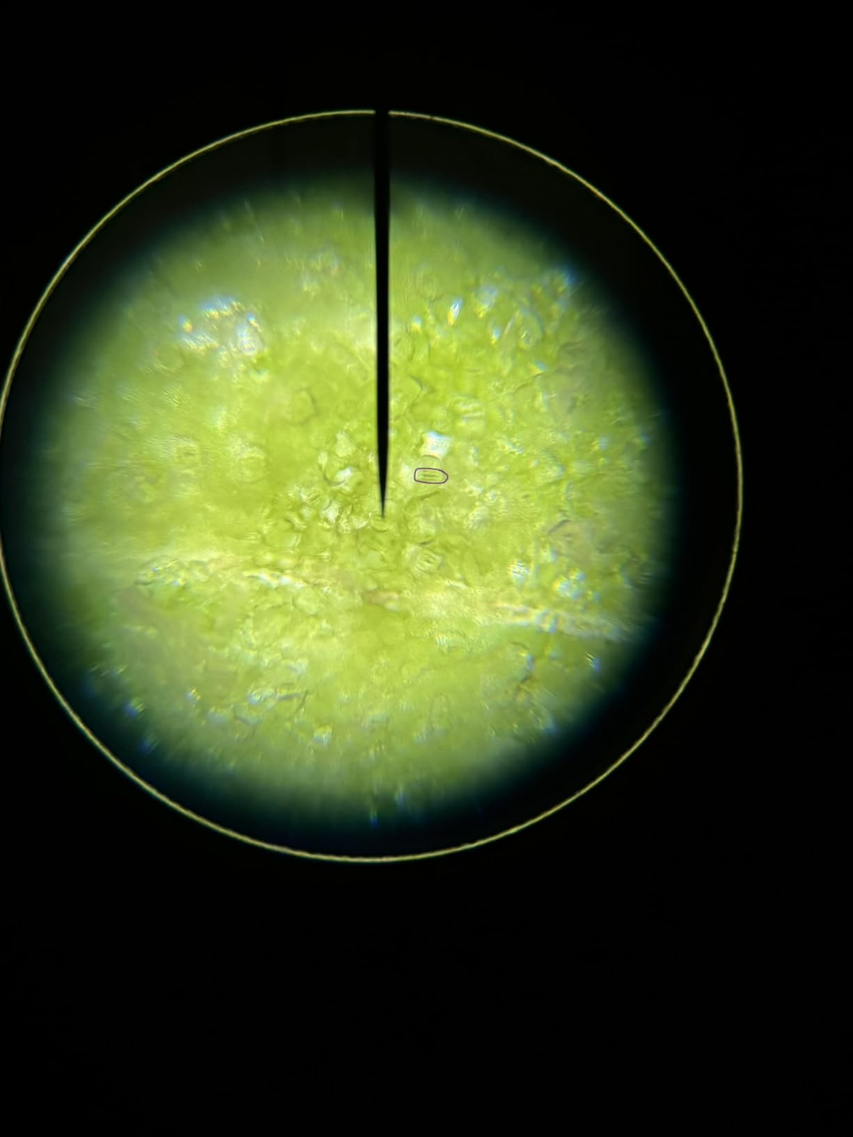 AmScope M150C 1000X All-Metal Optical Glass Lenses Cordless LED, 40X-1000X Magnification Range Compound Biological Microscope All-Metal Construction Cordless Battery Powered customer photo 1