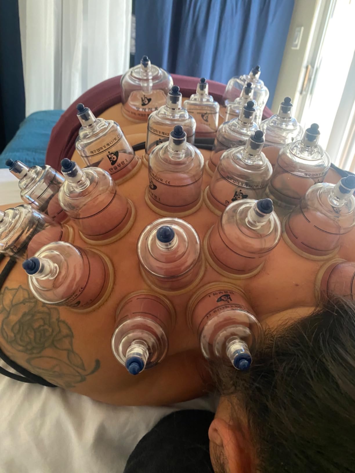 Hansol Professional Cupping Therapy Equipment 30 Cups Set with pumping handle and Extension Tube & English Manual (Made in Korea) customer photo 1