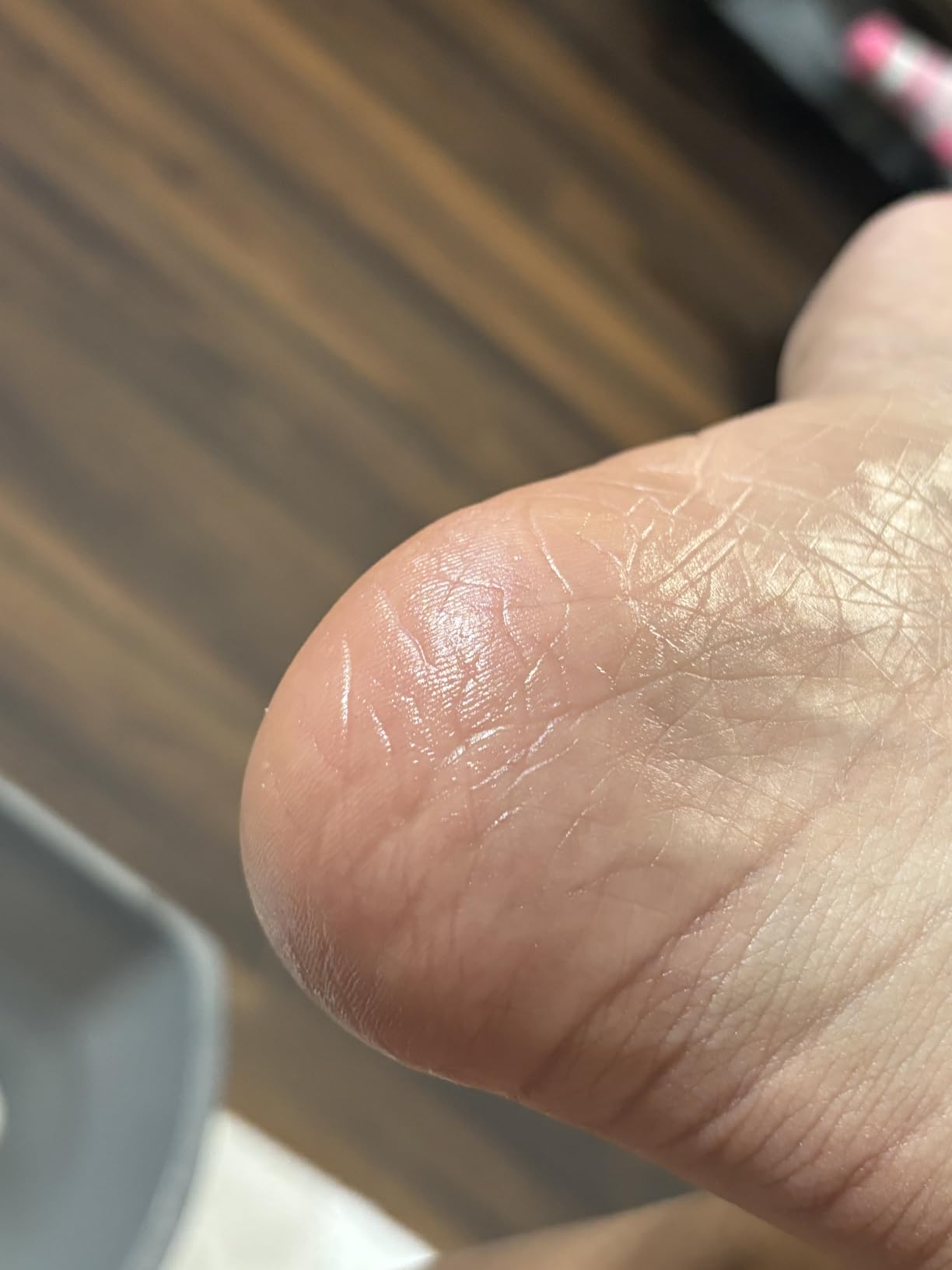 Lee Beauty 8oz Professional Gel Callus Remover for Feet - Original Fast-Acting Formula, Extra Strength for Cracked Heels & Dead Skin (Pack of 1) customer photo 1
