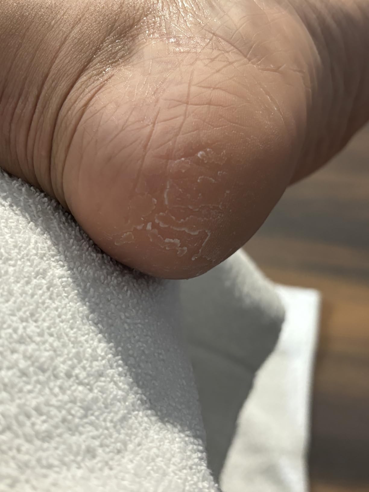 Lee Beauty 8oz Professional Gel Callus Remover for Feet - Original Fast-Acting Formula, Extra Strength for Cracked Heels & Dead Skin (Pack of 1) customer photo 2