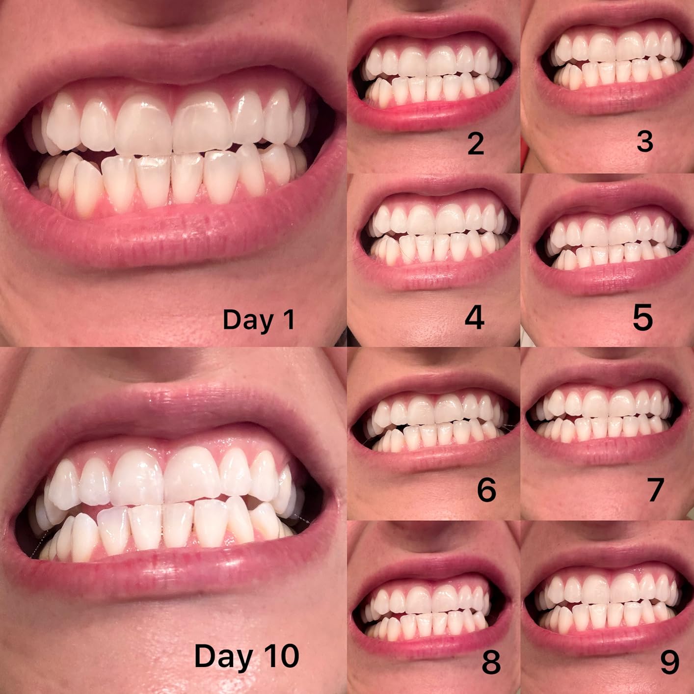 Crest Teeth Whitening Strips, Crest 3D Whitestrips Vivid Plus, Enamel Safe Teeth Whitening Kit, 12 Treatments (24 Strips), Visibly Whitens in Days, 8 Levels Whiter customer photo 2