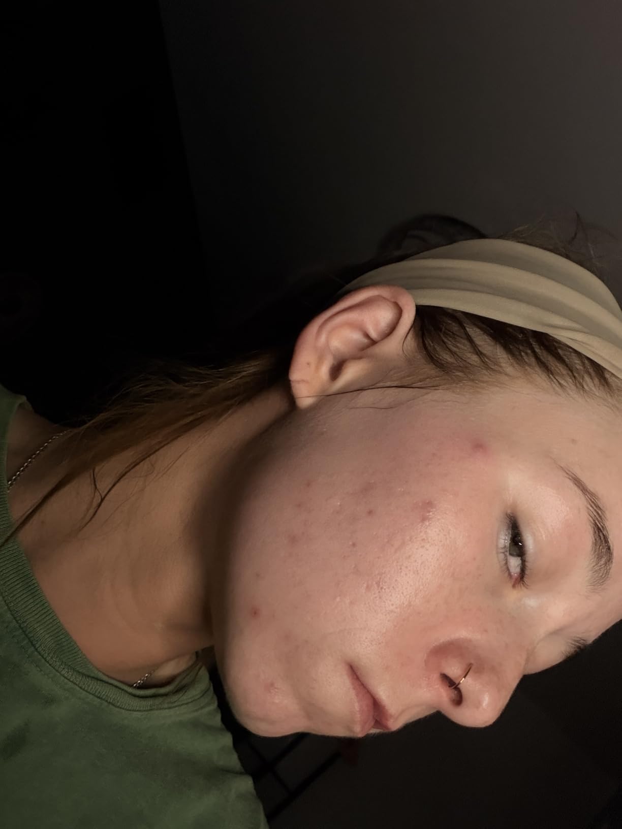 Paula's Choice SKIN PERFECTING 2% BHA Liquid Exfoliant | Gentle Salicylic Acid Facial Exfoliator for Blackheads, Enlarged Pores, Wrinkles & Fine Lines customer photo 1