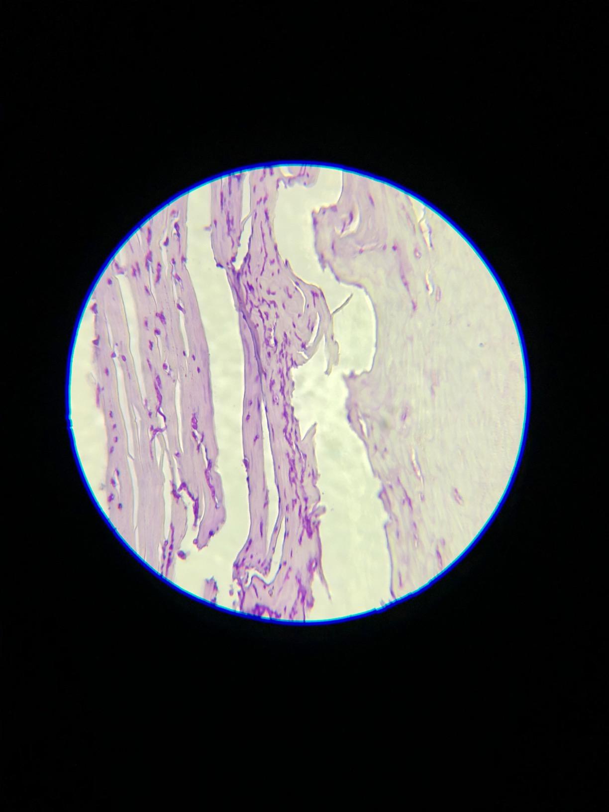Swift SW380T 40X-2500X Magnification, Siedentopf Head, Research-Grade Trinocular Microscope Compound Lab with Wide-Field 10X/25X Eyepieces, Mechanical Stage, Ultra-Precise Focusing, Camera-Compatible customer photo 1