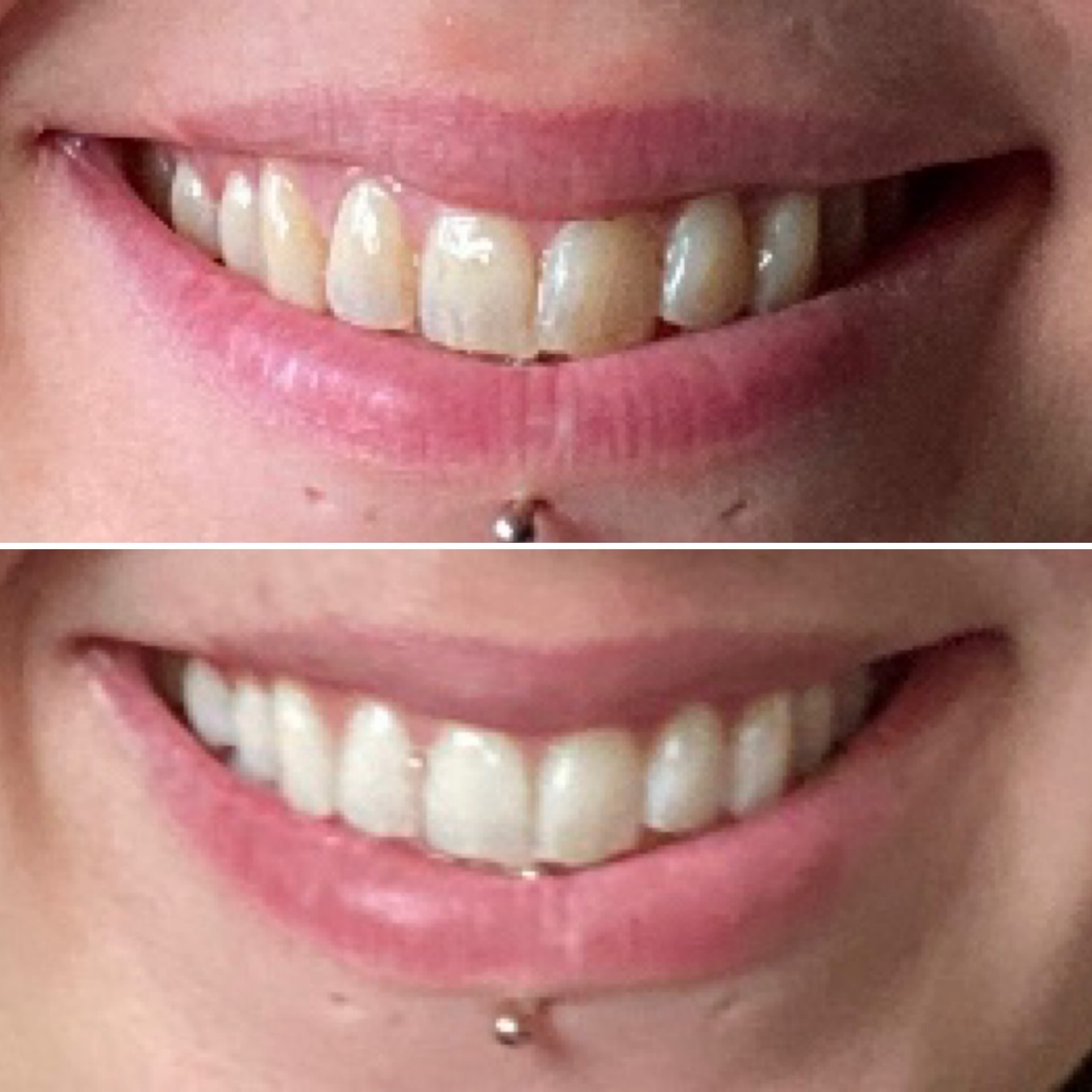 Crest Teeth Whitening Strips, Crest 3D Whitestrips 2 Week Smile Transformation, Enamel Safe Teeth Whitening Kit, 16 Treatments (32 Strips), Whiter Teeth in 2 Weeks, 11 Levels Whiter customer photo 2