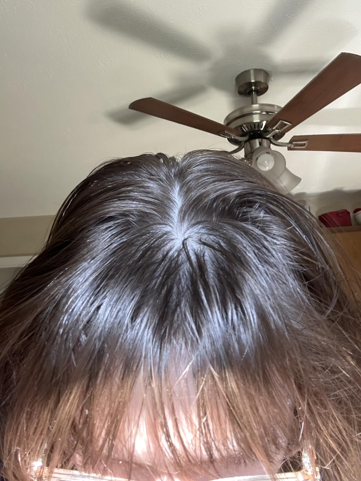 The Ordinary Hair Care Natural Moisturizing Factors + Hyaluronic Acid, Lightweight Hydrating Scalp Serum with Hyaluronic Acid and Squalane, 2 Fl Oz customer photo 1