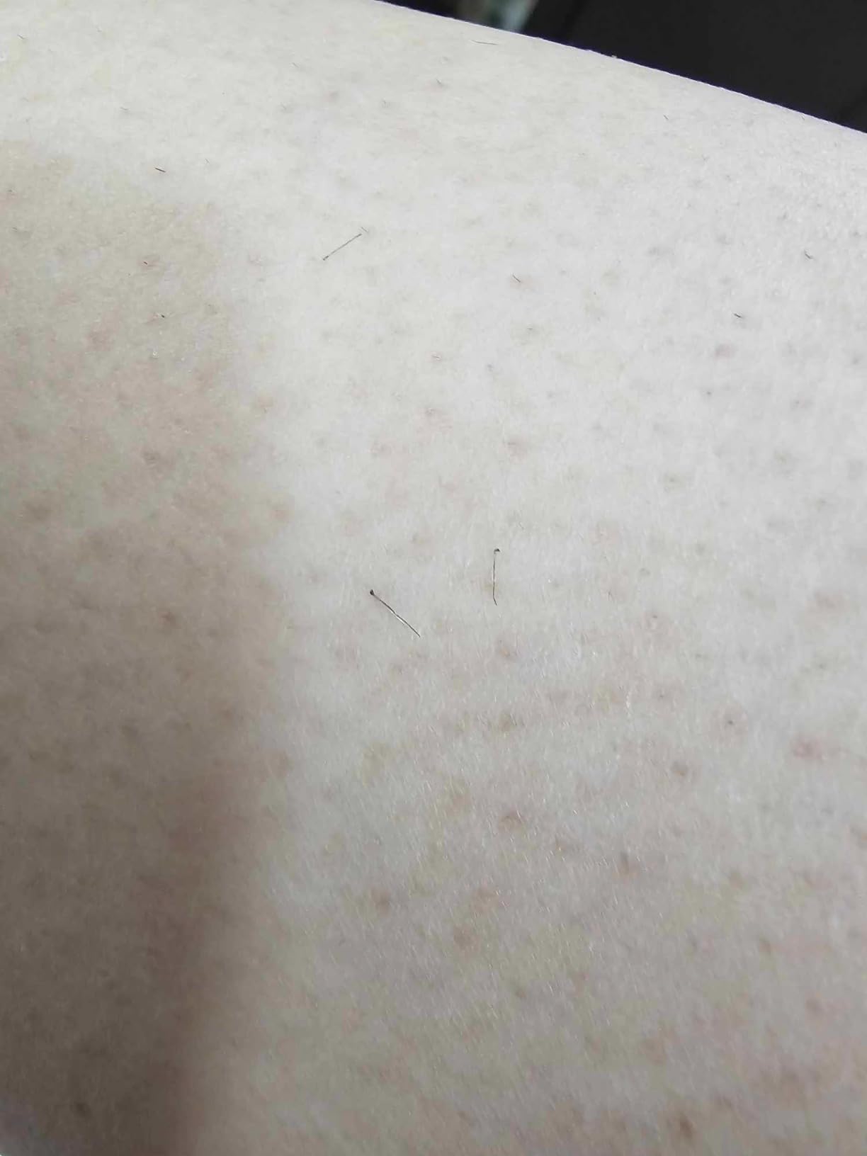 Braun Silk-épil 5 Epilator, Wet & Dry, Lasting Smooth Skin, SE5-230 customer photo 1