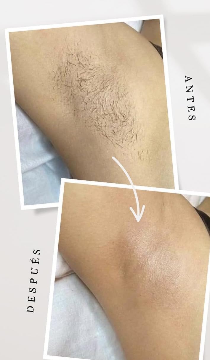 INIA HAUTE Pro Laser Hair Removal with Ice-Cooling Care for Women and Men, Painless At-Home IPL Hair Remover for Coarse Hair, Bikini All Body Areas customer photo 2