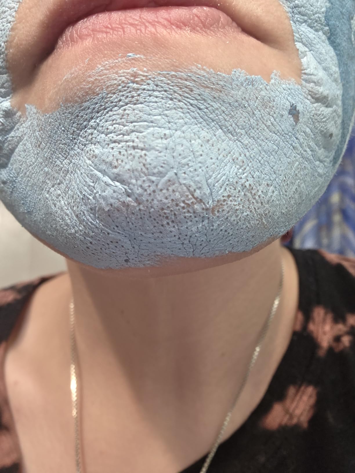 medicube Zero Pore Blackhead Mud Mask - Pore Cleansing & Gentle Exfoliating customer photo 1