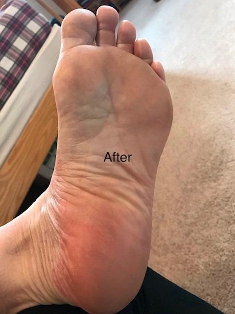 Tea Tree Oil Foot Soak with Epsom Salt - Made in USA - for Toenail irritations, Athletes Foot, Stubborn Foot Odor Scent, Softens Calluses & Soothes Sore Tired Feet - 16 Ounce customer photo 2